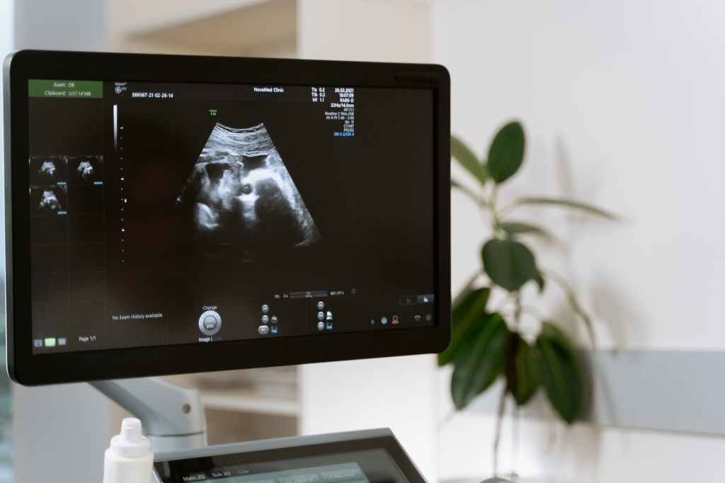 Przygotowanie mięśni dna miednicy do porodu – pomoc fizjoterapeuty uroginekologicznego.